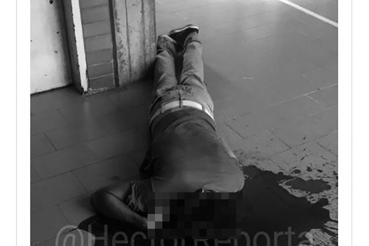 Por no dejarse robar le disparan en la cabeza a estudiante de la UDO Monagas (+Foto)