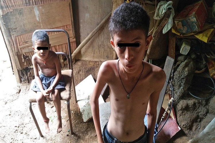 OSH: Venezolanos siguen entre la inseguridad alimentaria y la desnutrición