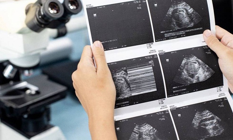 Hungría exigirá a las embarazadas escuchar latidos del corazón del feto antes de abortar