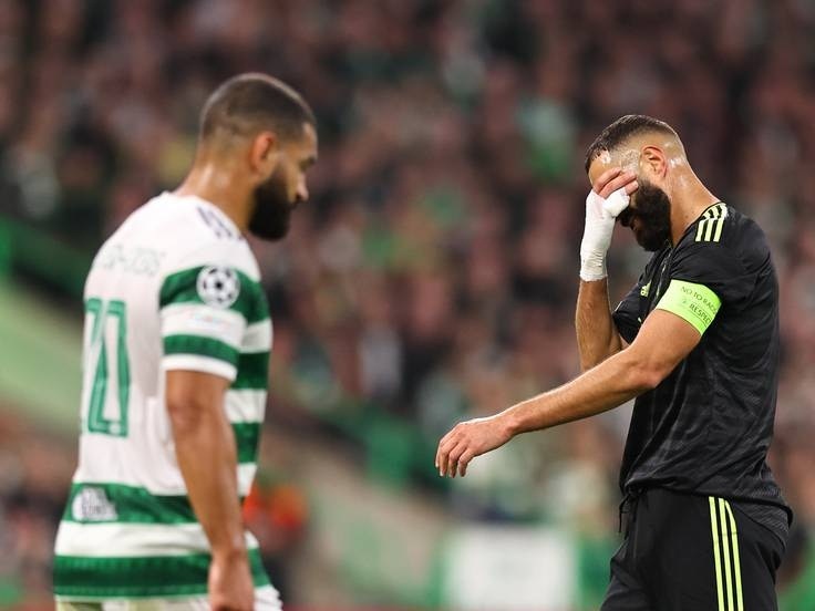 Karim Benzema sale lesionado de la cancha