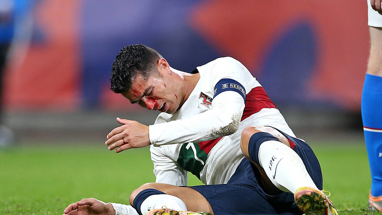 Ronaldo termina ensangrentado tras sufrir un duro golpe en la nariz
