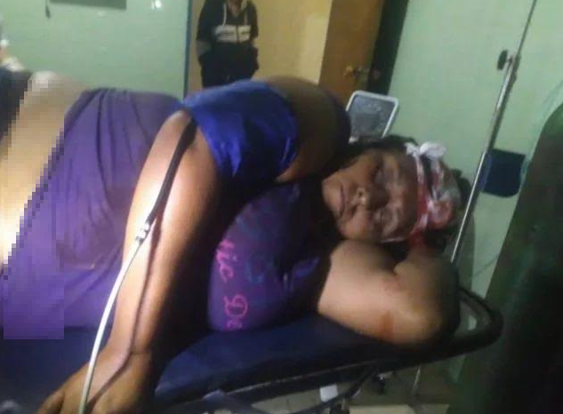 Buscan familiares de mujer herida tras accidente vial en Trujillo