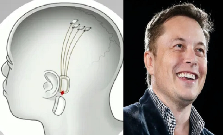 Musk espera implantar una computadora en el cerebro humano en seis meses
