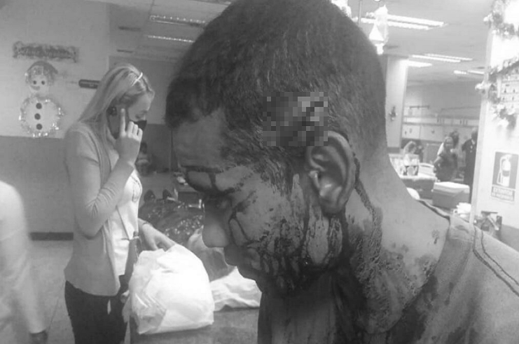 Oficial de la policía de Lara recibió disparo rasante en la cabeza a manos de asaltantes
