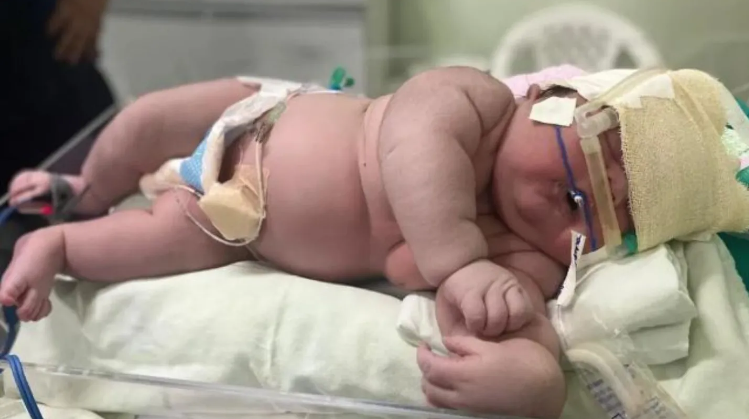 Nace bebé de más de 7 kilos en Brasil