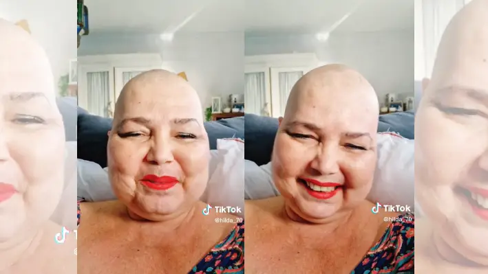 Muere «@Hilda» la influencer conocida por su lucha contra el cáncer de mama