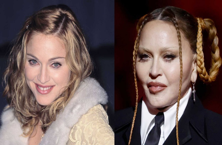 Madonna aparece en los Grammy irreconocible y con el rostro hinchado