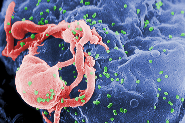 Mujer logra «curarse» del VIH luego de un trasplante de células madre