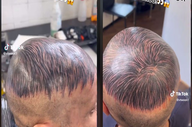 Viral| Hombre se tatuó en la cabeza un peluquín