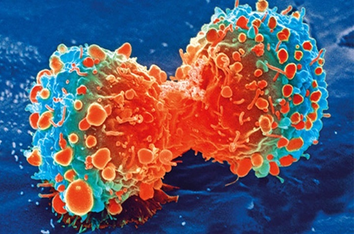Diseñan nanocápsulas para tratamiento de quimioterapia