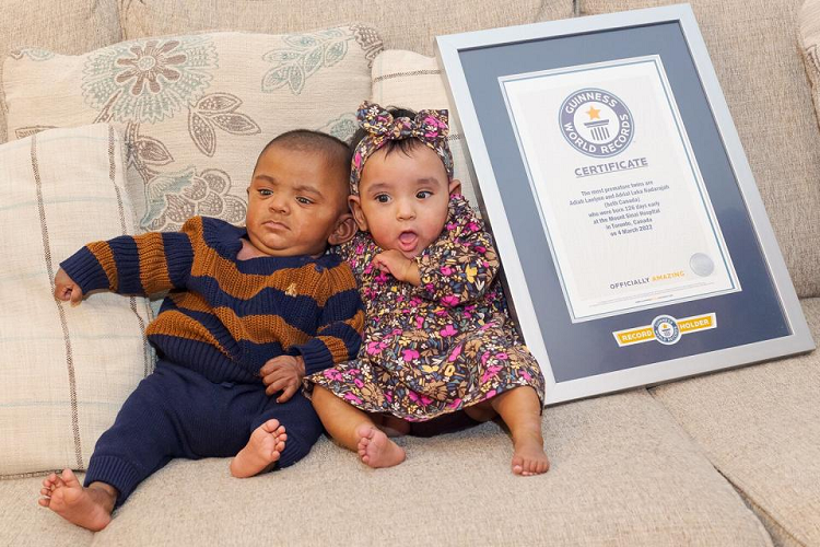 Libro Guinness de los Récords: Los gemelos más prematuros que nacieron a las 22 semanas