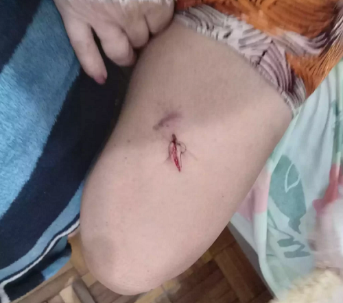 Docente venezolana fue apuñalada por una vecina en Argentina