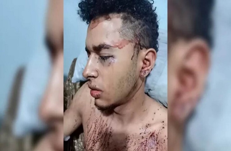 Venezolano fue atacado a puñaladas por reclamar a unos hombres que orinaron su moto