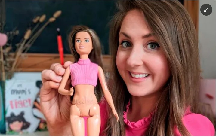 Diseñó una Barbie con estrías para promover la aceptación corporal