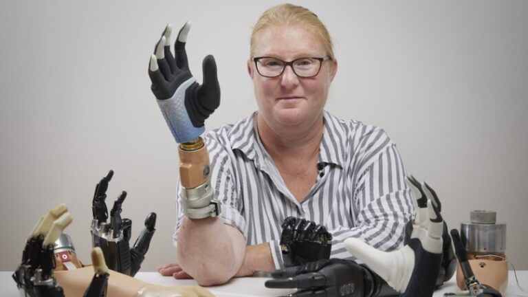 Implantan mano biónica que funciona con Inteligencia Artificial a una mujer