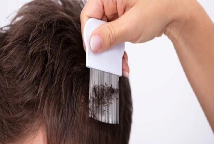 Insólito pero cierto: Los piojos viven mucho mejor en el cabello limpio que en el sucio