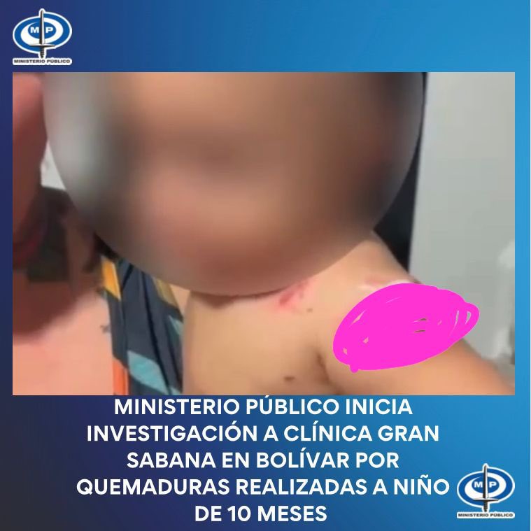 Ministerio Público investigará a clínica en Bolívar por quemaduras de un bebé
