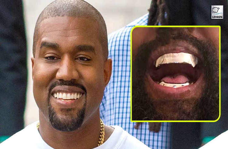 Kanye West estrena dentaduras postizas de titanio de 850.000 dólares