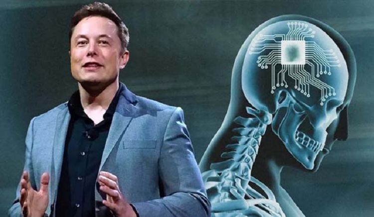 Neuralink: Elon Musk anuncia el primer implante de un chip en el cerebro de un humano
