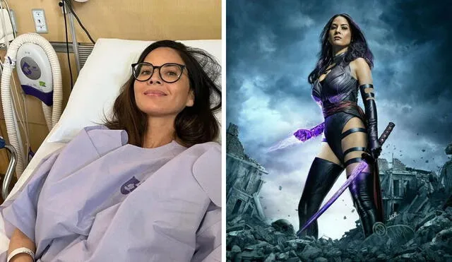 Actriz Olivia Munn de X-Men reveló que tiene cáncer de mama