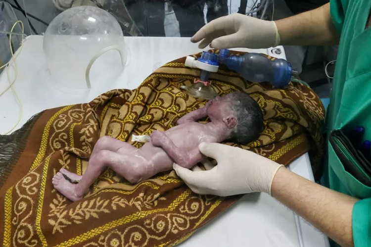 Médicos de Gaza salvan bebé realizando una cesárea a su madre agonizante