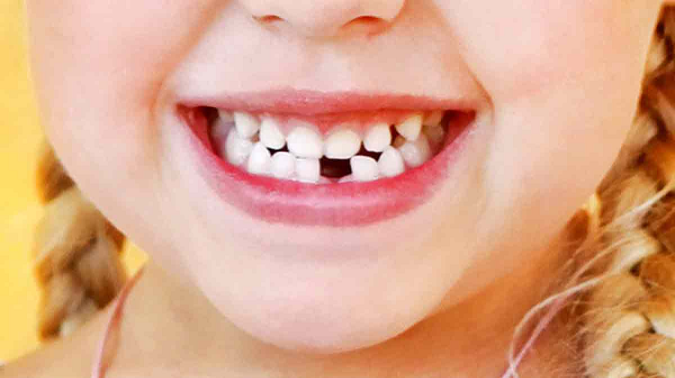 Japón desarrolla el primer fármaco para hacer crecer los dientes