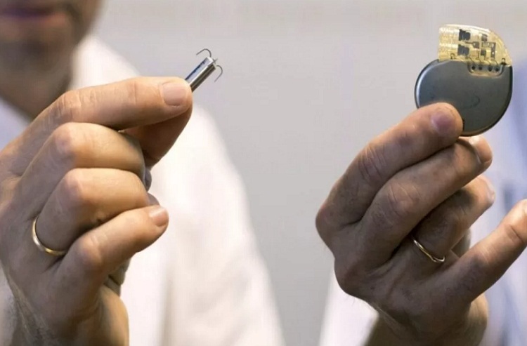 Realizan el primer implante de marcapasos sin cables en Venezuela