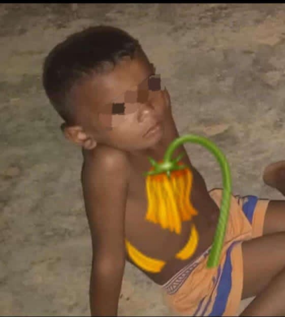 Niño de 4 años murió electrocutado y otro de 11 años quedó herido en el mismo hecho en Mauroa
