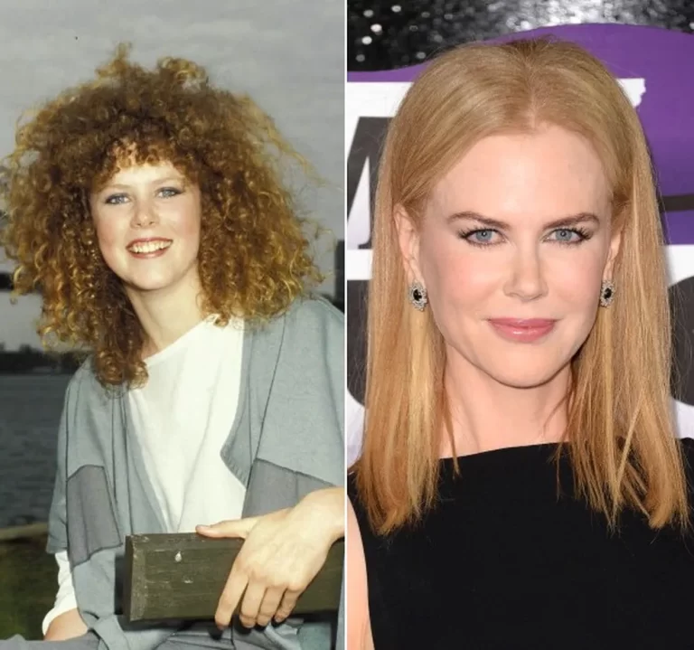 Nicole Kidman confesó que sufrió bullying durante su adolescencia por ser alta