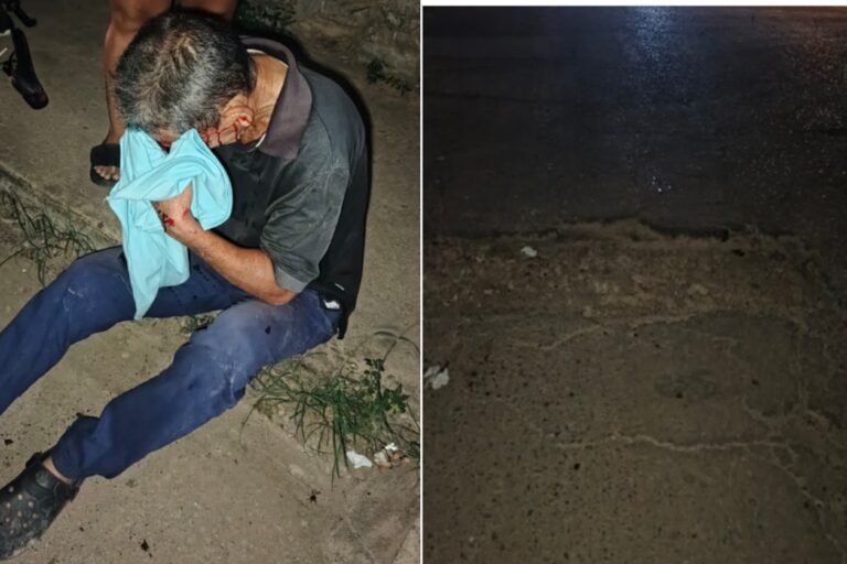 Hombre sufrió traumatismo craneoencefálico al caer en su bicicleta en un hueco en el sector Concordia de Coro