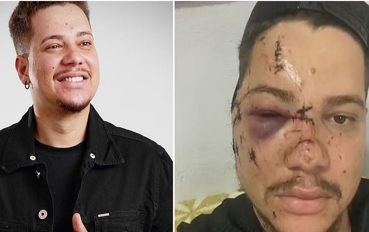 Cantante brasileño agredido en concierto recibe 32 puntos en el rostro